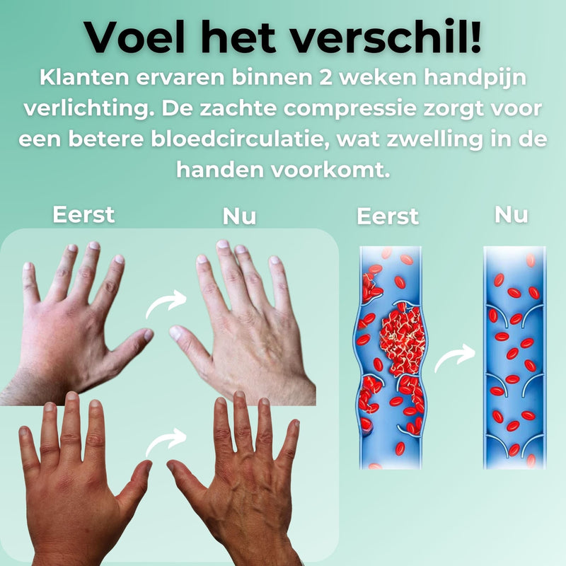 Pain Relief Compression Gloves