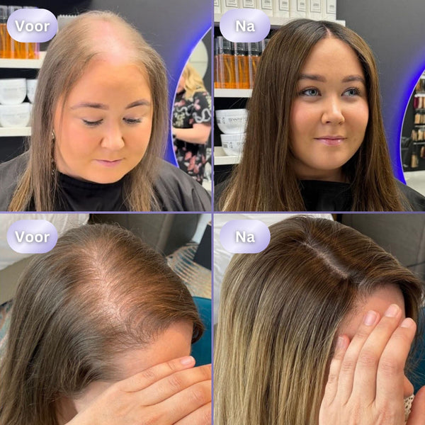 HairGlow 3in1 Haargroei Borstel
