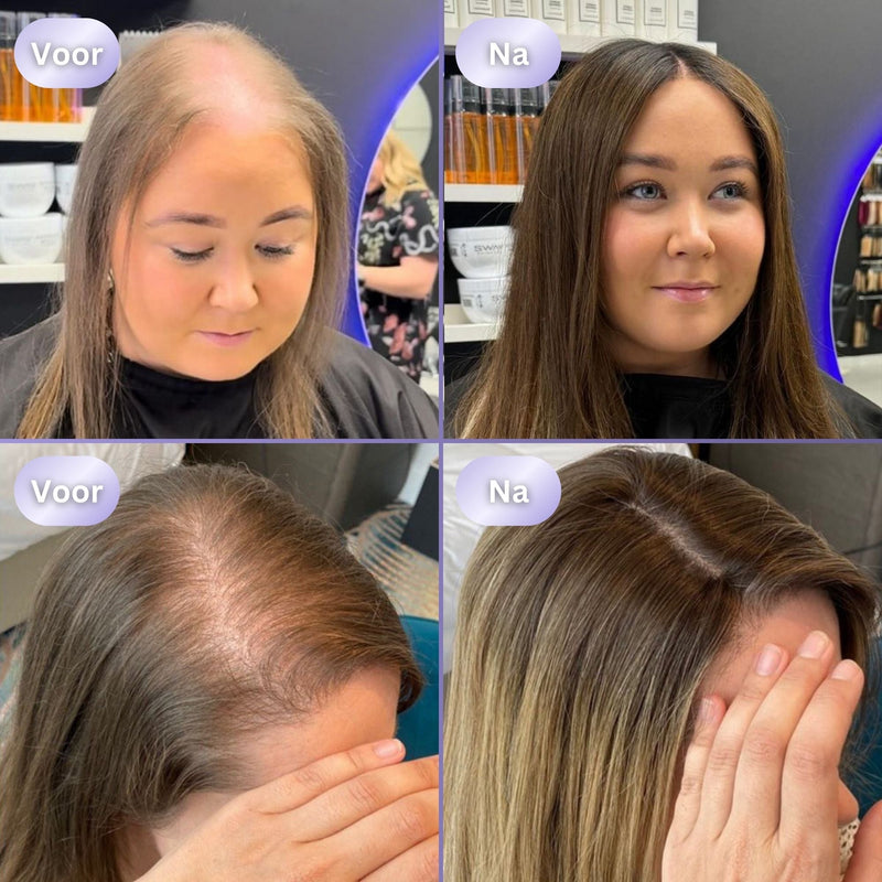 HairGlow 3in1 Haargroei Borstel