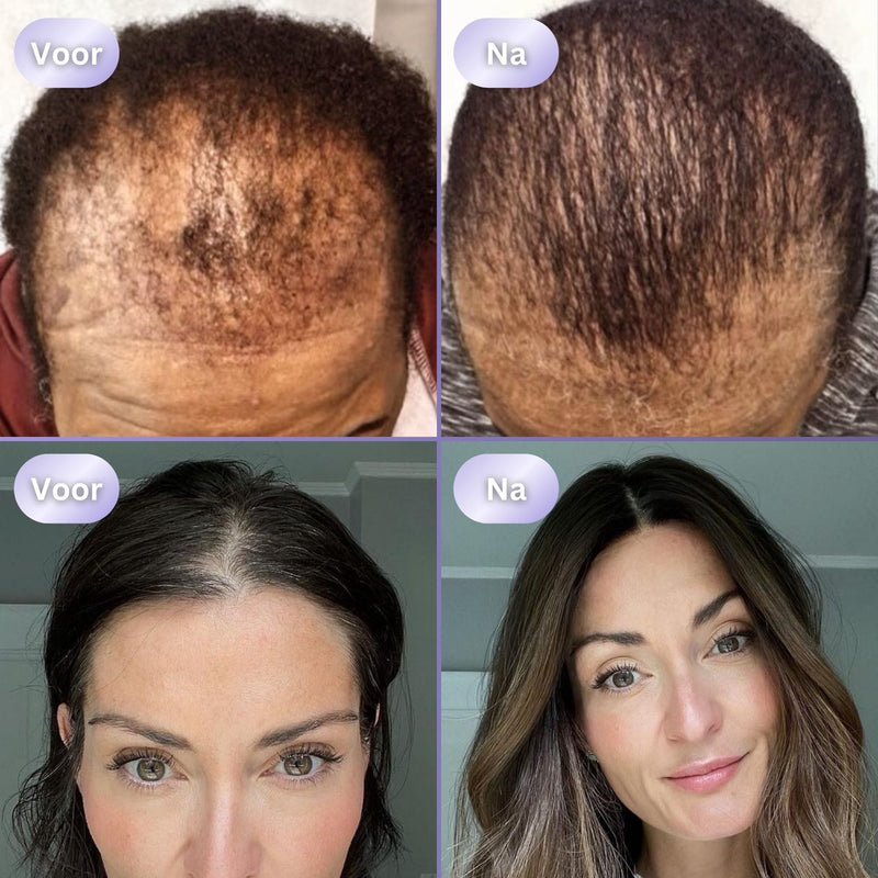 HairGlow 3in1 Haargroei Borstel