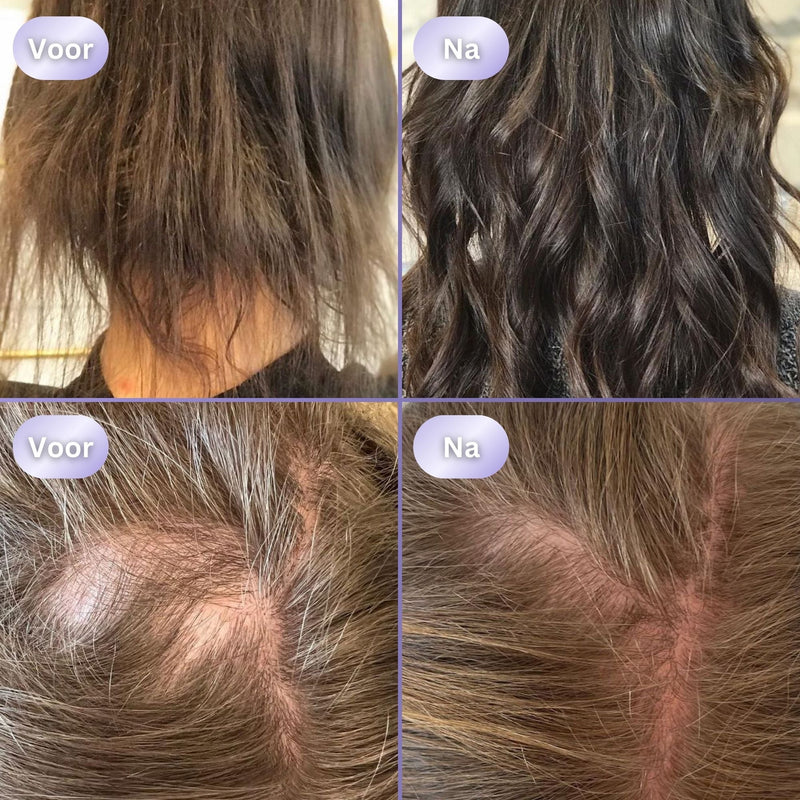 HairGlow 3in1 Haargroei Borstel