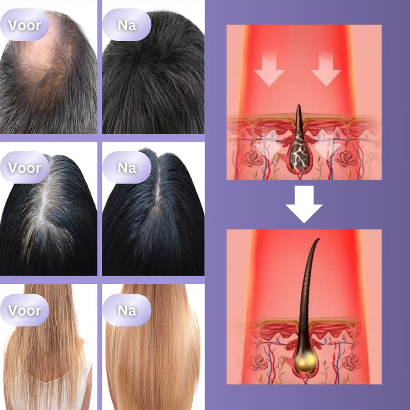 HairGlow 3in1 Haargroei Borstel